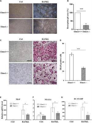 ELMO1 Regulates RANKL-Stimulated Differentiation and Bone Resorption of Osteoclasts